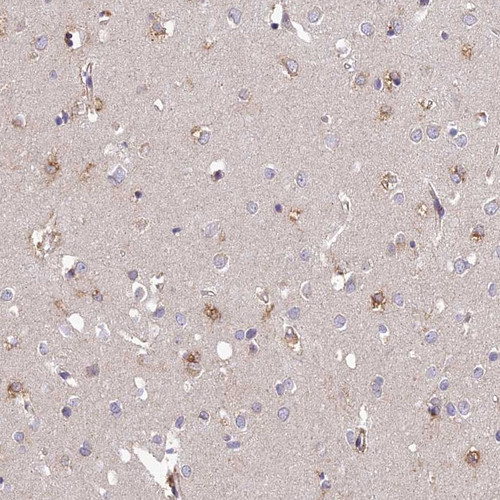 Immunohistochemical staining of human cerebral cortex shows moderate positivity in a subset of glial cells.
