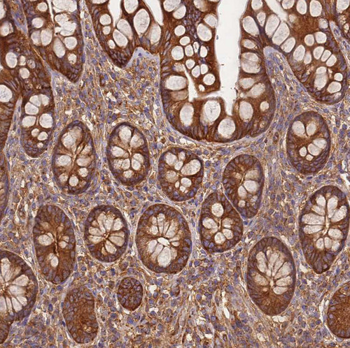 Immunohistochemical staining of human small intestine shows strong cytoplasmic positivity in glandular cells.