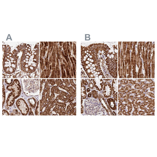 Immunohistochemical staining of human colon, heart muscle, kidney and liver using Anti-ATP5A1 antibody HPA040622 (A) shows similar protein distribution across tissues to independent antibody HPA044202 (B).