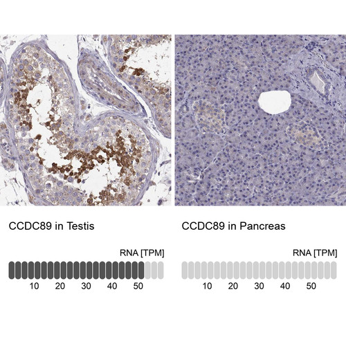 Immunohistochemistry analysis in human testis and pancreas tissues using Anti-CCDC89 antibody. Corresponding CCDC89 RNA-seq data are presented for the same tissues.