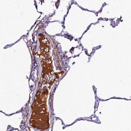 Immunohistochemical staining of human lung shows distinct positivity in plasma. 