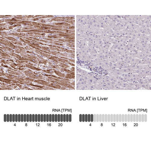 Immunohistochemistry analysis in human heart muscle and liver tissues using Anti-DLAT antibody. Corresponding DLAT RNA-seq data are presented for the same tissues.