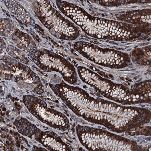 Immunohistochemical staining of human stomach shows strong cytoplasmic positivity in glandular cells.