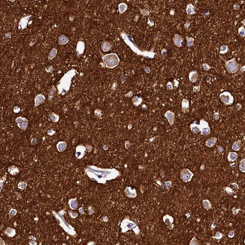 Immunohistochemical staining of human cerebral cortex shows moderate cytoplasmic positivity in neuronal cells.