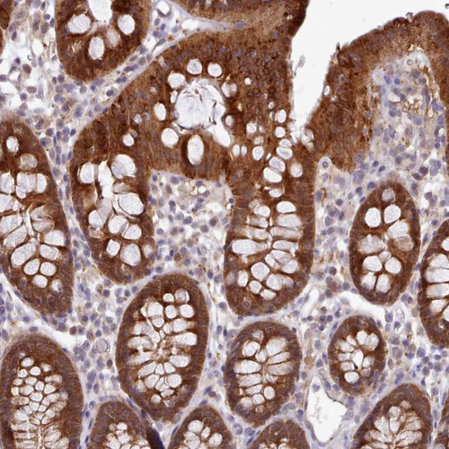 Immunohistochemical staining of human colon shows strong cytoplasmic positivity in glandular cells.