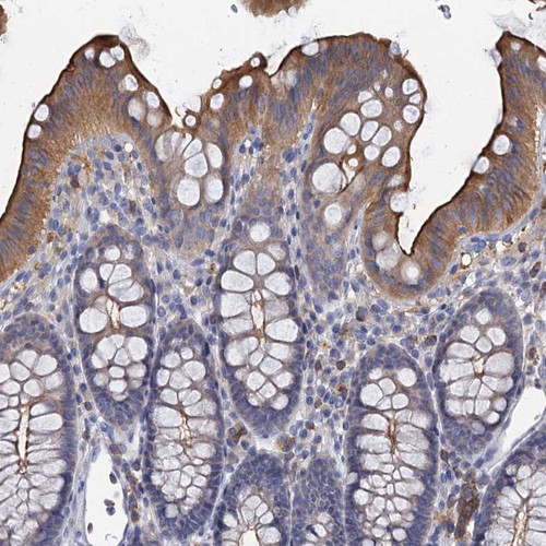 Immunohistochemical staining of human colon shows moderate cytoplasmic and membranous positivity in glandular cells.