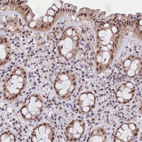 Immunohistochemical staining of human rectum shows moderate nuclear positivity in glandular cells.