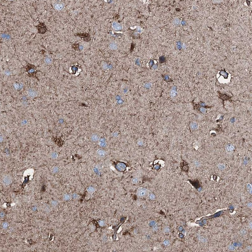 Immunohistochemical staining of human cerebral cortex shows strong cytoplasmic positivity in glial cells.