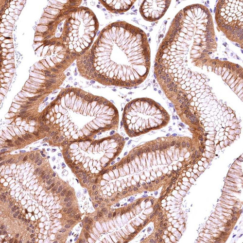 Immunohistochemical staining of human stomach, upper shows moderate cytoplasmic and nuclear positivity in glandular cells.