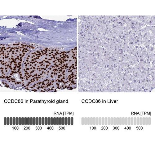 Immunohistochemistry analysis in human parathyroid gland and liver tissues using HPA041117 antibody. Corresponding CCDC86 RNA-seq data are presented for the same tissues.