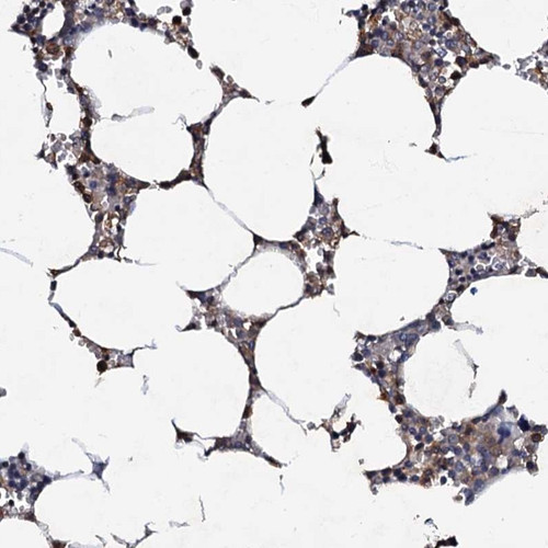 Immunohistochemical staining of human bone marrow shows cytoplasmic positivity in hematopoietic cells.