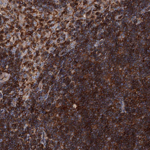 Immunohistochemical staining of human Lymph node shows strong cytoplasmic positivity in germinal center and non-germinal center cells.