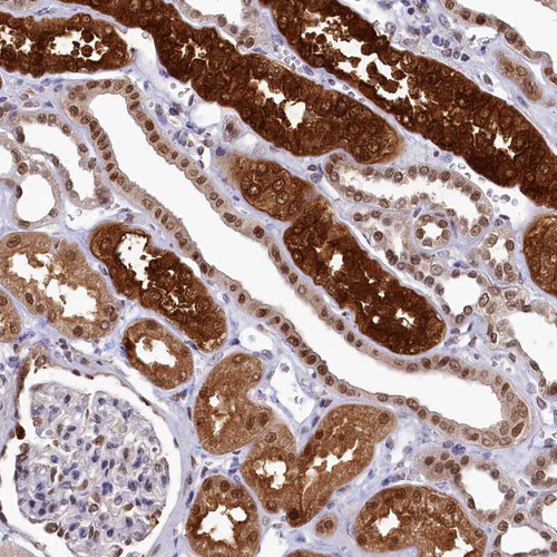 Immunohistochemical staining of human kidney shows strong cytoplasmic and nuclear positivity in cells in tubules.