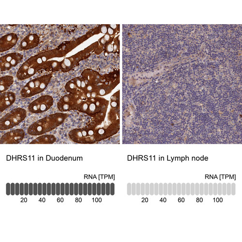Immunohistochemistry analysis in human duodenum and lymph node tissues using HPA041226 antibody. Corresponding DHRS11 RNA-seq data are presented for the same tissues.