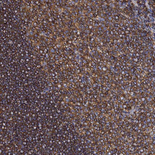 Immunohistochemical staining of human tonsil shows strong positivity in lymphoid cells.