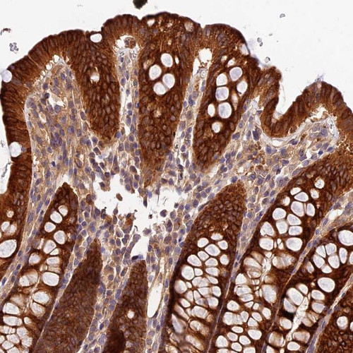 Immunohistochemical staining of human colon shows strong cytoplasmic positivity in glandular cells.