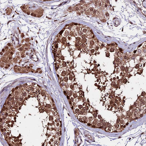Immunohistochemical staining of human testis shows strong nuclear and cytoplasmic positivity in cells in seminiferous ducts and leydig.