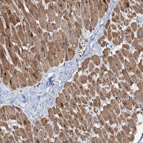 Immunohistochemical staining of human heart muscle shows moderate to strong cytoplasmic positivity in cardiomyocytes.