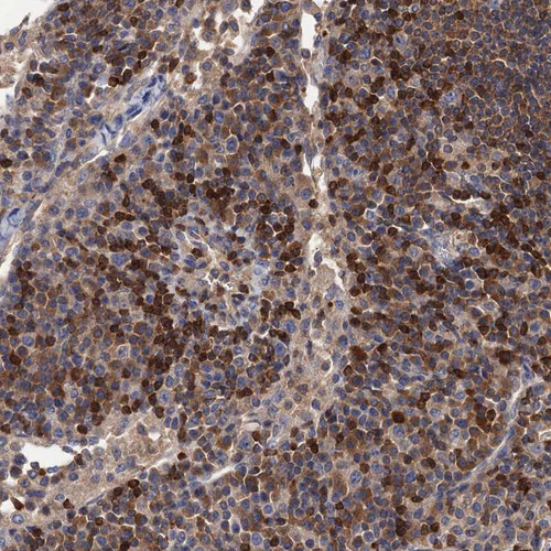 Immunohistochemical staining of human lymph node shows strong membranous positivity in lymphocytes.