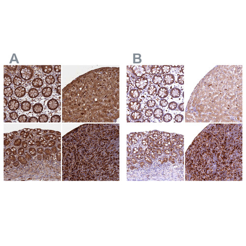 Immunohistochemical staining of human colon, liver, small intestine and spleen using Anti-BLVRB antibody HPA041698 (A) shows similar protein distribution across tissues to independent antibody HPA041937 (B).