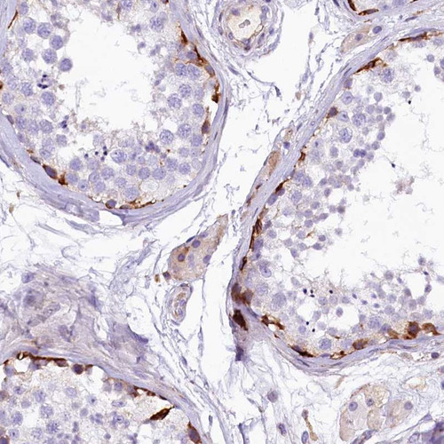 Immunohistochemical staining of human testis shows strong positivity in spematogonia in seminiferous ducts.