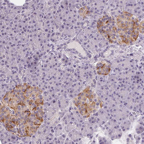 Immunohistochemical staining of human pancreas shows moderate cytoplasmic positivity in islets of Langerhans.