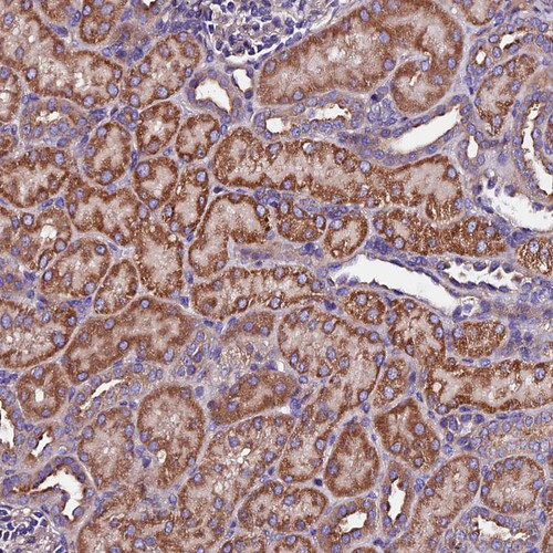 Immunohistochemical staining of human kidney shows strong granular cytoplasmic positivity in cells in tubules.