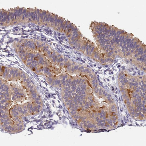 Immunohistochemical staining of human fallopian tube shows moderate membranous and cytoplasmic positivity in glandular cells.