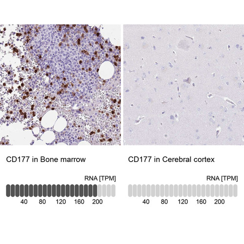 Immunohistochemistry analysis in human bone marrow and cerebral cortex tissues using Anti-CD177 antibody. Corresponding CD177 RNA-seq data are presented for the same tissues.