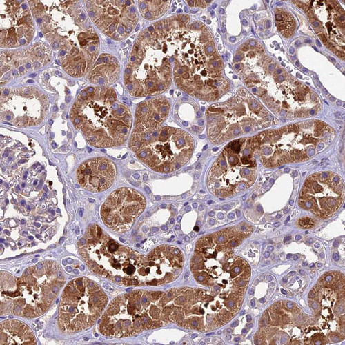 Immunohistochemical staining of human kidney shows moderate positivity in extracellular matrix in cells in tubules.