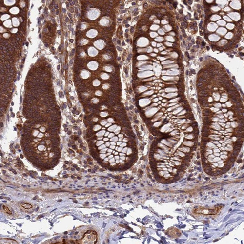 Immunohistochemical staining of human colon shows strong cytoplasmic positivity in glandular cells.