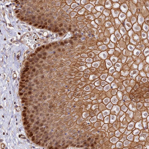 Immunohistochemical staining of human esophagus shows moderate cytoplasmic, membranous and nuclear positivity in squamous epithelial cells.