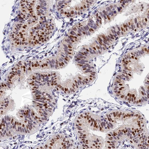 Immunohistochemical staining of human fallopian tube shows strong nuclear positivity in glandular cells.