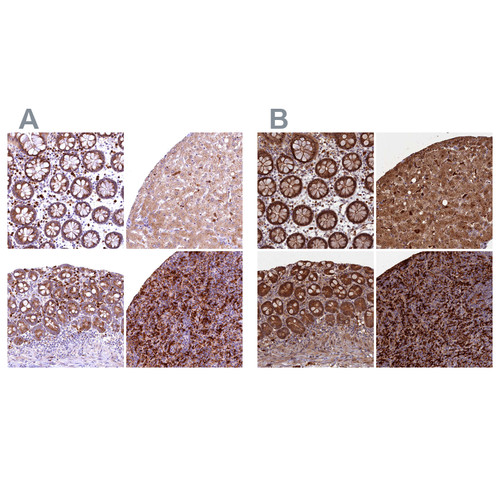Immunohistochemical staining of human colon, liver, small intestine and spleen using Anti-BLVRB antibody HPA041937 (A) shows similar protein distribution across tissues to independent antibody HPA041698 (B).