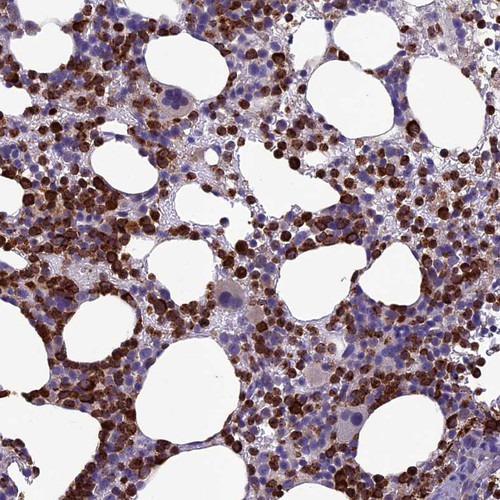Immunohistochemical staining of human bone marrow shows strong cytoplasmic positivity in hematopoietic cells.