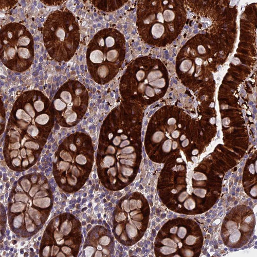 Immunohistochemical staining of human colon shows strong cytoplasmic positivity in glandular cells.