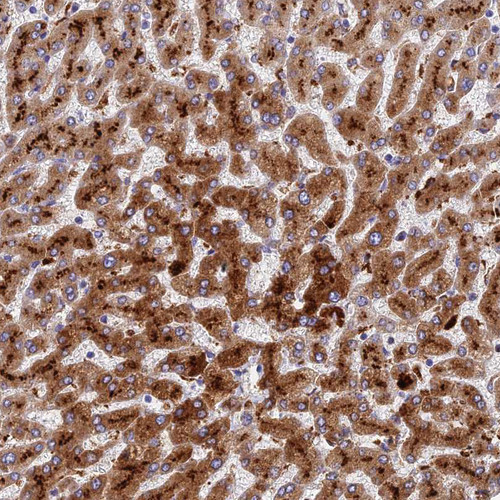 Immunohistochemical staining of human liver shows strong granular cytoplasmic positiviity in hepatocytes.