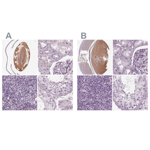 Immunohistochemical staining of human eye, kidney, lymph node and testis using Anti-BFSP1 antibody HPA042038 (A) shows similar protein distribution across tissues to independent antibody HPA040748 (B).