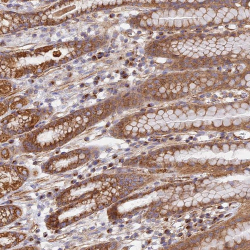 Immunohistochemical staining of human stomach, lower shows moderate cytoplasmic positivity in glandular cells.