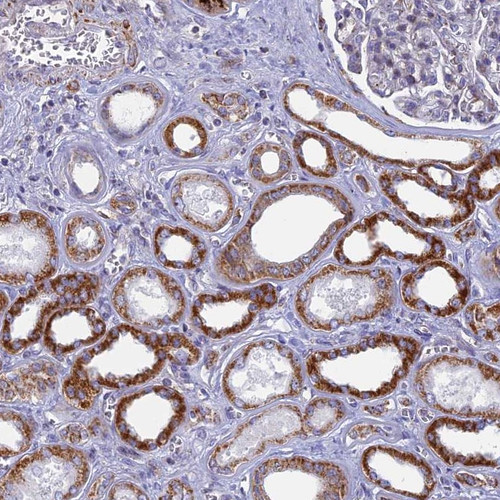Immunohistochemical staining of human kidney shows strong cytoplasmic positivity in cells in tubules.