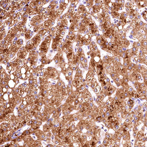 Immunohistochemical staining of human liver shows strong granular cytoplasmic positivity in hepatocytes.