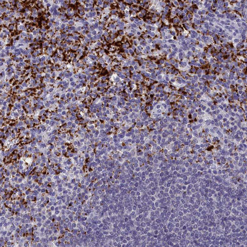Immunohistochemical staining of human spleen shows strong granular cytoplasmic positivity in cells in red pulp.