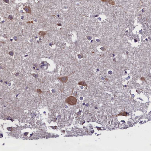 Immunohistochemical staining of human cerebral cortex shows moderate cytoplasmic positivity in neurons.