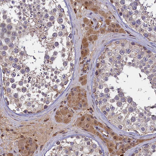 Immunohistochemical staining of human testis shows moderate cytoplasmic positivity in Leydig cells.