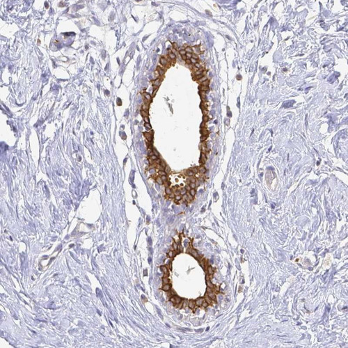 Immunohistochemical staining of human breast shows strong cytoplasmic and membranous positivity in glandular cells.