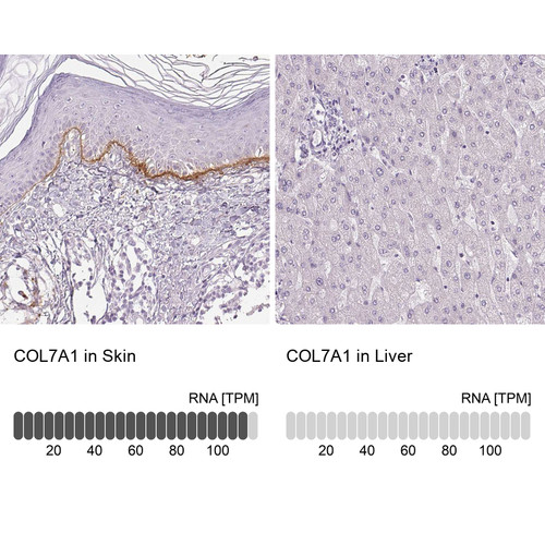 Immunohistochemistry analysis in human skin and liver tissues using HPA042420 antibody. Corresponding COL7A1 RNA-seq data are presented for the same tissues.