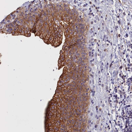 Immunohistochemical staining of human urinary bladder shows strong membrane and cytoplasmic positivity in urothelial cells.