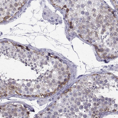 Immunohistochemical staining of human testis shows strong cytoplasmic positivity in cells in seminiferous ducts.