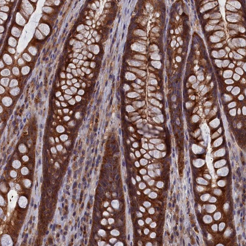 Immunohistochemical staining of human rectum shows strong cytoplasmic positivity in glandular cells.