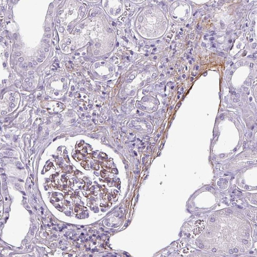 Immunohistochemical staining of human kidney shows moderate cytoplasmic and membranous positivity in cells in glomeruli.